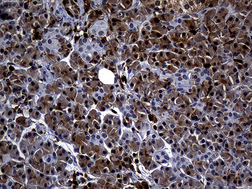 ALOX5 / 5-LOX Antibody - Immunohistochemical staining of paraffin-embedded Human pancreas tissue within the normal limits using anti-ALOX5 mouse monoclonal antibody. (Heat-induced epitope retrieval by 1mM EDTA in 10mM Tris buffer. (pH8.5) at 120°C for 3 min. (1:2000)