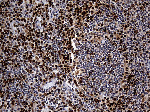 ALOX5 / 5-LOX Antibody - Immunohistochemical staining of paraffin-embedded Human tonsil within the normal limits using anti-ALOX5 mouse monoclonal antibody. (Heat-induced epitope retrieval by 1mM EDTA in 10mM Tris buffer. (pH8.5) at 120°C for 3 min. (1:2000)