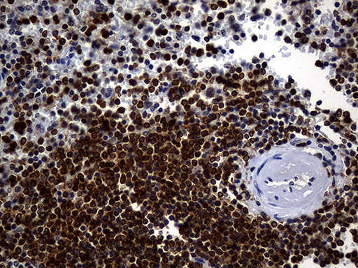 ALOX5 / 5-LOX Antibody - Immunohistochemical staining of paraffin-embedded Human spleen tissue within the normal limits using anti-ALOX5 mouse monoclonal antibody. (Heat-induced epitope retrieval by Tris-EDTA(1:2000)
