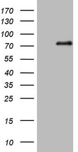 ALOX5 / 5-LOX Antibody - HEK293T cells were transfected with the pCMV6-ENTRY control. (Left lane) or pCMV6-ENTRY ALOX5. (Right lane) cDNA for 48 hrs and lysed. Equivalent amounts of cell lysates. (5 ug per lane) were separated by SDS-PAGE and immunoblotted with anti-ALOX5.