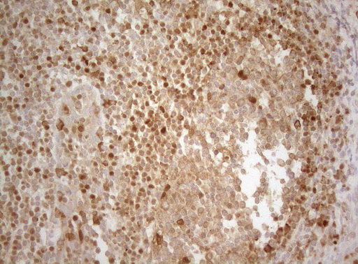 ALOX5 / 5-LOX Antibody - Immunohistochemical staining of paraffin-embedded Human tonsil within the normal limits using anti-ALOX5 mouse monoclonal antibody. (Heat-induced epitope retrieval by 1mM EDTA in 10mM Tris buffer. (pH8.5) at 120°C for 3 min. (1:150)