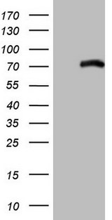 ALOX5 / 5-LOX Antibody - HEK293T cells were transfected with the pCMV6-ENTRY control (Left lane) or pCMV6-ENTRY ALOX5 (Right lane) cDNA for 48 hrs and lysed. Equivalent amounts of cell lysates (5 ug per lane) were separated by SDS-PAGE and immunoblotted with anti-ALOX5.