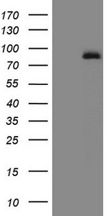 ALOX5 / 5-LOX Antibody - HEK293T cells were transfected with the pCMV6-ENTRY control. (Left lane) or pCMV6-ENTRY ALOX5. (Right lane) cDNA for 48 hrs and lysed