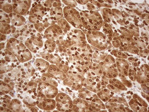 ALOX5 / 5-LOX Antibody - Immunohistochemical staining of paraffin-embedded Human pancreas tissue using anti-ALOX5 mouse monoclonal antibody. (Heat-induced epitope retrieval by 1mM EDTA in 10mM Tris buffer. (pH8.5) at 120°C for 3 min. (1:150)