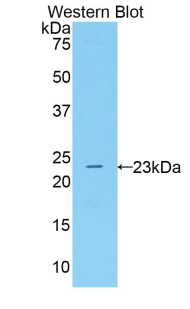 ALOX5 / 5-LOX Antibody - Western blot of recombinant ALOX5 / 5-Lipoxygenase.  This image was taken for the unconjugated form of this product. Other forms have not been tested.