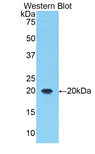 ALOX5 / 5-LOX Antibody - Western blot of recombinant ALOX5 / 5-Lipoxygenase.  This image was taken for the unconjugated form of this product. Other forms have not been tested.