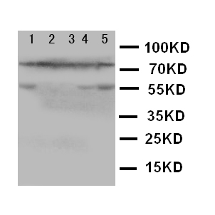 ALOX5 / 5-LOX Antibody - WB of ALOX5 / 5-Lipoxygenase antibody. Lane 1: SW620 Cell Lysate. Lane 2: JURKAT Cell Lysate. Lane 3: COLO320 Cell Lysate. Lane 4: A549 Cell Lysate. Lane 5: MCF-7 Cell Lysate.