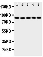 ALOX5 / 5-LOX Antibody - Anti-ALOX5 antibody, Western blotting All lanes: Anti ALOX5 at 0.5ug/ml Lane 1: SW620 Whole Cell Lysate at 40ug Lane 2: JURKAT Whole Cell Lysate at 40ug Lane 3: COLO320 Whole Cell Lysate at 40ug Lane 4: A549 Whole Cell Lysate at 40ug Lane 5: MCF-7 Whole Cell Lysate at 40ug Predicted bind size: 78KD Observed bind size: 78KD