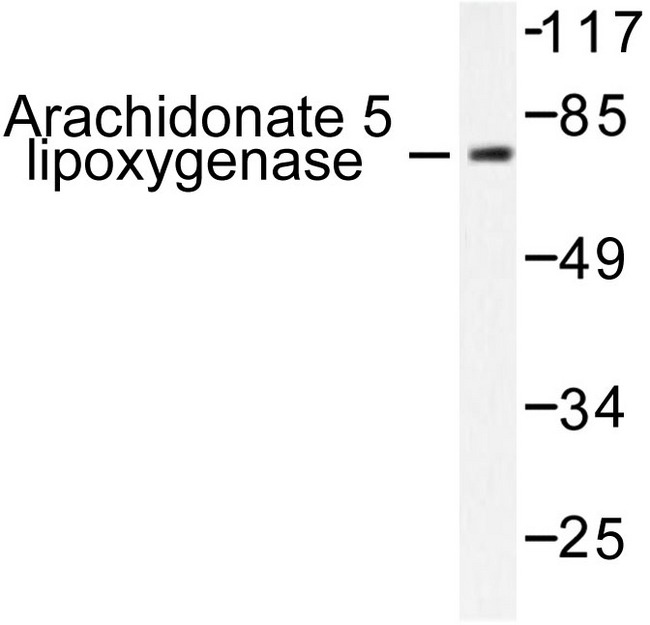 ALOX5 / 5-LOX Antibody - Western blot of ALOX5 (E267) pAb in extracts from HUVEC cells.