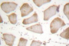 ALOX5 / 5-LOX Antibody - IHC of ALOX5 (E267) pAb in paraffin-embedded human skeletal muscle tissue.