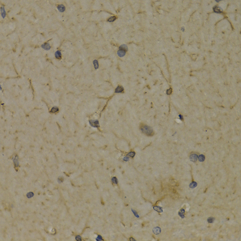 ALOX5 / 5-LOX Antibody - Immunohistochemistry of paraffin-embedded rat brain tissue.
