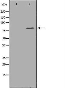 ALOX5 / 5-LOX Antibody - Western blot analysis of extracts of HepG2 cells using ALOX5 antibody. The lane on the left is treated with the antigen-specific peptide.