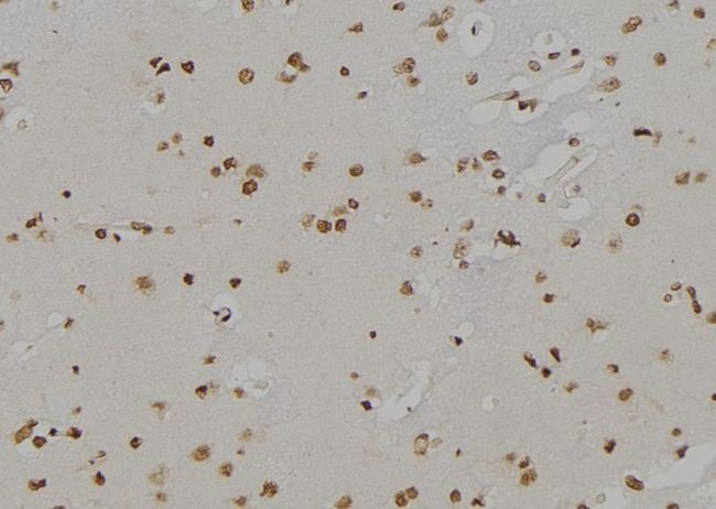 ALOX5 / 5-LOX Antibody - 1:100 staining human brain tissue by IHC-P. The sample was formaldehyde fixed and a heat mediated antigen retrieval step in citrate buffer was performed. The sample was then blocked and incubated with the antibody for 1.5 hours at 22°C. An HRP conjugated goat anti-rabbit antibody was used as the secondary.