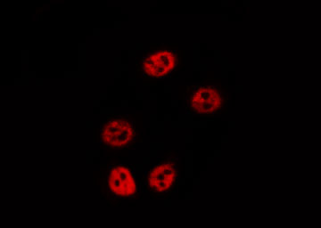ALOX5 / 5-LOX Antibody - Staining HuvEc cells by IF/ICC. The samples were fixed with PFA and permeabilized in 0.1% Triton X-100, then blocked in 10% serum for 45 min at 25°C. The primary antibody was diluted at 1:200 and incubated with the sample for 1 hour at 37°C. An Alexa Fluor 594 conjugated goat anti-rabbit IgG (H+L) antibody, diluted at 1/600, was used as secondary antibody.