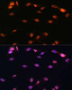 ALOX5 / 5-LOX Antibody - Immunofluorescence analysis of C6 cells using ALOX5 Polyclonal Antibody at dilution of 1:100.Blue: DAPI for nuclear staining.