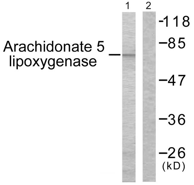 ALOX5 / 5-LOX Antibody - Western blot analysis of extracts from HuvEc cells, using Arachidonate 5 Lipoxygenase (Ab-271) antibody.