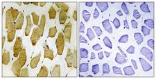 ALOX5 / 5-LOX Antibody - Immunohistochemistry analysis of paraffin-embedded human skeletal muscle, using Arachidonate 5 Lipoxygenase (Phospho-Ser271) Antibody. The picture on the right is blocked with the phospho peptide.