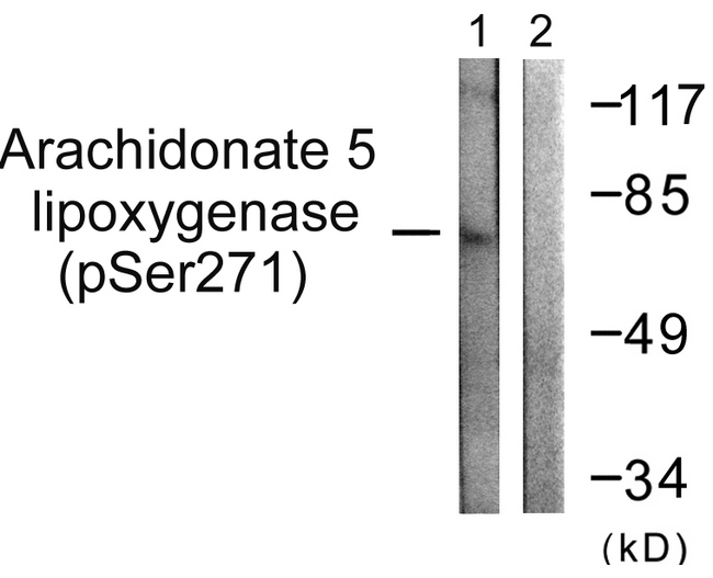 ALOX5 / 5-LOX Antibody - Western blot analysis of lysates from HUVEC cells, using Arachidonate 5 Lipoxygenase (Phospho-Ser271) Antibody. The lane on the right is blocked with the phospho peptide.