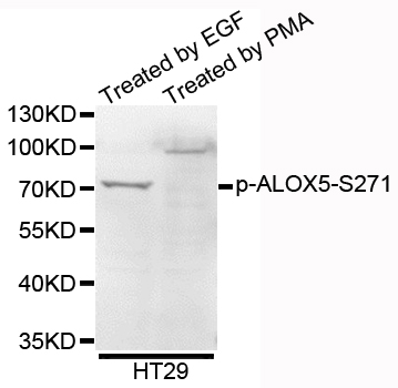 ALOX5 / 5-LOX Antibody - Western blot analysis of extracts of HT29 cells.