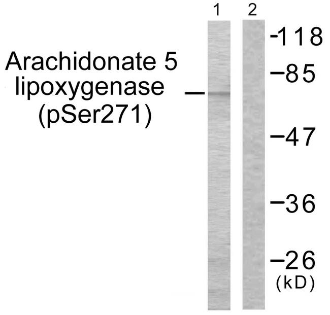 ALOX5 / 5-LOX Antibody - Western blot analysis of extracts from HuvEc cells, using Arachidonate 5 Lipoxygenase (Phospho-Ser271) antibody.