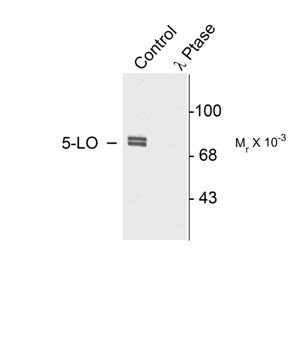ALOX5 / 5-LOX Antibody - Western blot of rat cortex lysate showing specific immunolabeling of the ~80k doublet of 5-LO phosphorylated at Ser523 (Control). The phosphospecificity of this labeling is shown in the second lane (lambda-phosphatase: l-Ptase). The blot is identical to the control except that it was incubated in l-Ptase (1200 units for 30 min) before being exposed to the Anti-Ser523 5-LO. The immunolabeling is completely eliminated by treatment with l-Ptase.