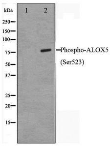 ALOX5 / 5-LOX Antibody - Western blot of HUVEC cell lysate using Phospho-ALOX5(Ser523) Antibody