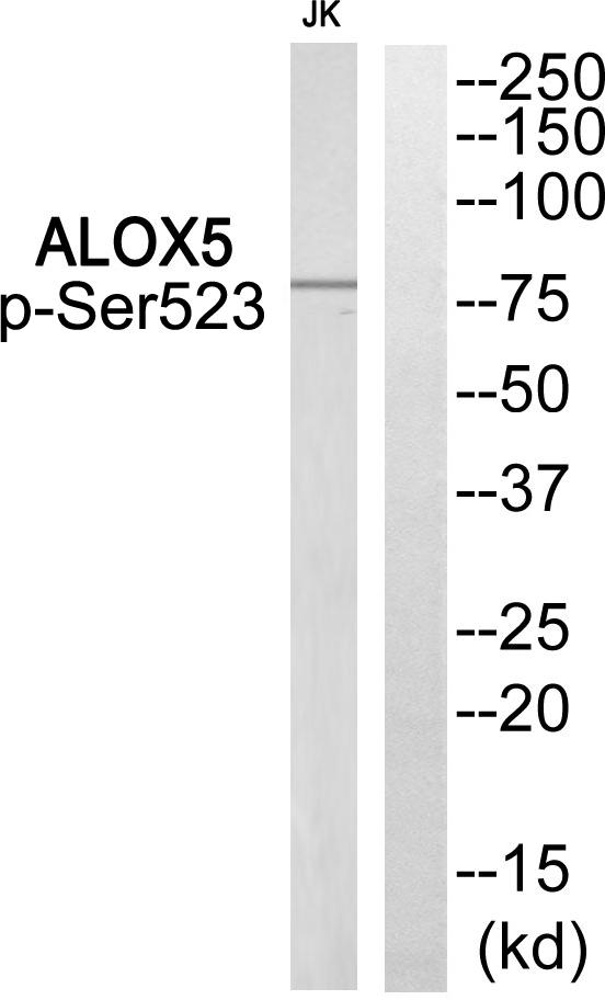 ALOX5 / 5-LOX Antibody - Western blot analysis of extracts from Jurkat cells, using ALOX5 (Phospho-Ser523) Antibody.