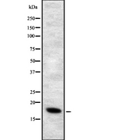 ALOX5AP / FLAP Antibody - Western blot analysis of ALOX5AP using HepG2 whole cells lysates