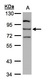 ALOXE3 Antibody - Sample (30 ug whole cell lysate). A: Hep G2 . 7.5% SDS PAGE. ALOXE3 antibody diluted at 1:1000