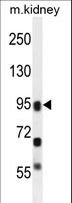 ALOXE3 Antibody - ALOXE3 Antibody western blot of mouse kidney tissue lysates (35 ug/lane). The ALOXE3 antibody detected the ALOXE3 protein (arrow).