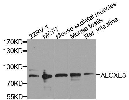 ALOXE3 Antibody - Western blot analysis of extract of various cells.