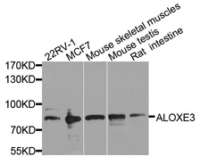 ALOXE3 Antibody - Western blot analysis of extract of various cells.