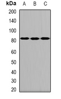ALOXE3 Antibody - Western blot analysis of ALOXE3 expression in MCF7 (A); mouse testis (B); rat intestine (C) whole cell lysates.