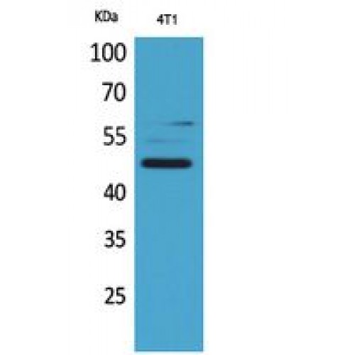 Alpha-1-Antichymotrypsin Antibody - Western blot of AACT antibody