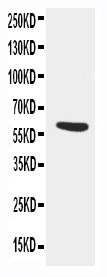 Alpha-1-Antichymotrypsin Antibody - WB of SERPINA3 antibody. WB: SMMC Cell Lysate.