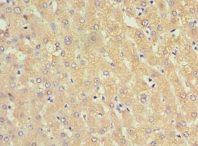 Alpha-1-Antichymotrypsin Antibody - Immunohistochemistry of paraffin-embedded human liver using antibody at 1:100 dilution.