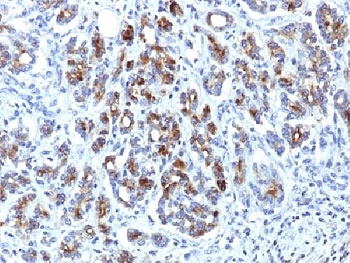Alpha-1-Antichymotrypsin Antibody - IHC testing of FFPE human pancreas with Alpha-1-Antichymotrypsin antibody (clone AACT/1451). Required HIER: steam sections in pH6, 10mM citrate buffer for 10-20 min.