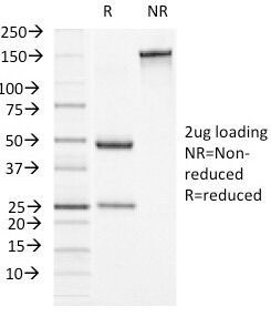 Alpha-1-Antichymotrypsin Antibody - SDS-PAGE Analysis of Purified, BSA-Free Alpha-1-Antichymotrypsin Antibody (clone AACT/1451). Confirmation of Integrity and Purity of the Antibody.