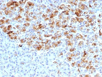 Alpha-1-Antichymotrypsin Antibody - IHC testing of FFPE human pancreas with Alpha-1-Antichymotrypsin antibody (clone AACT/1452). Required HIER: steam sections in pH6, 10mM citrate buffer for 10-20 min.