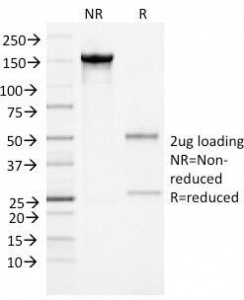 Alpha-1-Antichymotrypsin Antibody - SDS-PAGE Analysis of Purified, BSA-Free Alpha-1-Antichymotrypsin Antibody (clone AACT/1452). Confirmation of Integrity and Purity of the Antibody.