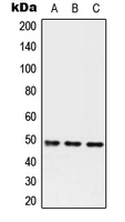 Alpha-1-Antichymotrypsin Antibody - Western blot analysis of Serpin A3 expression in HEK293T (A); Raw264.7 (B); H9C2 (C) whole cell lysates.