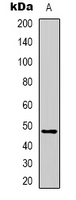 Alpha-1-Antichymotrypsin Antibody - Western blot analysis of Serpin A3 expression in HepG2 (A) whole cell lysates.