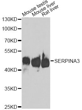 Alpha-1-Antichymotrypsin Antibody - Western blot analysis of extracts of various cell lines, using SERPINA3 antibody at 1:1000 dilution. The secondary antibody used was an HRP Goat Anti-Rabbit IgG (H+L) at 1:10000 dilution. Lysates were loaded 25ug per lane and 3% nonfat dry milk in TBST was used for blocking. An ECL Kit was used for detection and the exposure time was 90s.