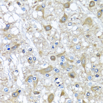 Alpha-1-Antichymotrypsin Antibody - Immunohistochemistry of paraffin-embedded rat brain using SERPINA3 antibodyat dilution of 1:100 (40x lens).