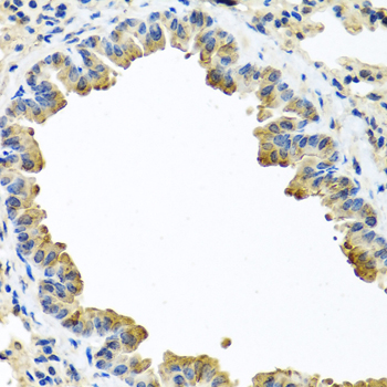 Alpha-1-Antichymotrypsin Antibody - Immunohistochemistry of paraffin-embedded mouse lung using SERPINA3 antibodyat dilution of 1:100 (40x lens).