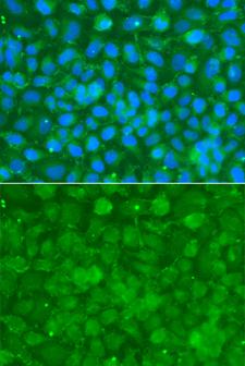Alpha-1-Antichymotrypsin Antibody - Immunofluorescence analysis of A549 cells using SERPINA3 antibody. Blue: DAPI for nuclear staining.