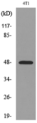 Alpha-1-Antichymotrypsin Antibody - Western blot analysis of lysate from 4T1 cells, using SERPINA3 Antibody.