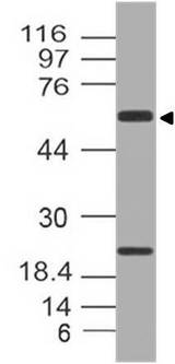 Alpha-1-Antichymotrypsin Antibody - Fig-1: Western blot analysis of Anti-Chymotrypsin. Anti-Anti-Chymotrypsin antibody was used at 1 µg/ml on A549 lysate.