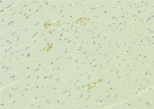 Alpha-1-Antichymotrypsin Antibody - 1:100 staining mouse liver tissue by IHC-P. The sample was formaldehyde fixed and a heat mediated antigen retrieval step in citrate buffer was performed. The sample was then blocked and incubated with the antibody for 1.5 hours at 22°C. An HRP conjugated goat anti-rabbit antibody was used as the secondary.