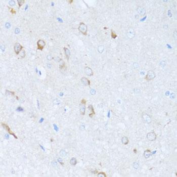 Alpha-1-Antichymotrypsin Antibody - Immunohistochemistry of paraffin-embedded Rat brain using SERPINA3 Polyclonal Antibody at dilution of 1:100 (40x lens).